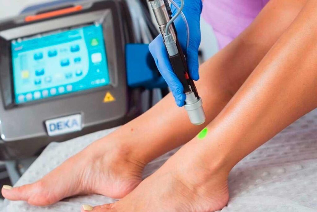 Лазерная эпиляция: как происходит удаление волос, и как долго держится эффект?